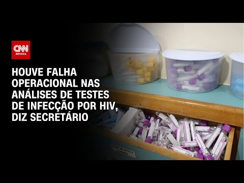Houve falha operacional nas análises de testes de infecção por HIV, diz secretário | BASTIDORES CNN