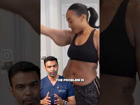 Losing Muscle on Your Weight Loss Journey?