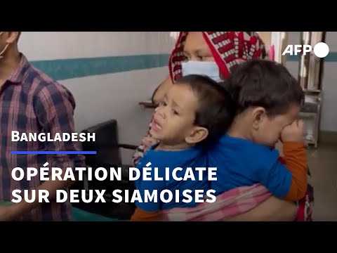 Bangladesh: des chirurgiens vont séparer des jumelles siamoises | AFP