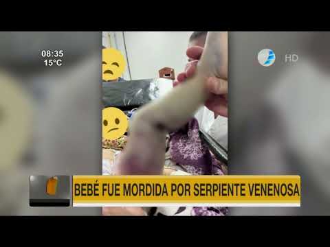 Bebé fue mordida por serpiente venenosa en San Juan Nepomuceno