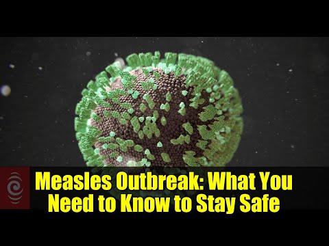 Measles Outbreak: What You Need to Know to Stay Safe
