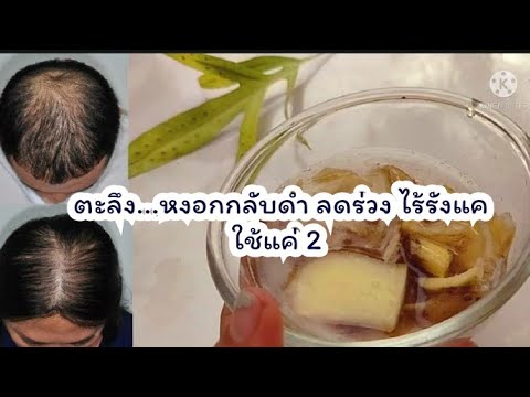 สูตรแก้ผมหงอก-ลดร่วง-โดยไม่ใช้ สูตรแก้ผมหงอก-ลดร่วง-โดยไม่ใช้