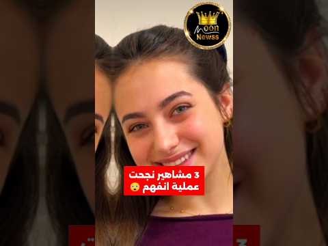 ثلاث انجح عملية تجميل انف للمشاهير 😲لانا محمد وقمر طائي وسيدرا من الاجمل