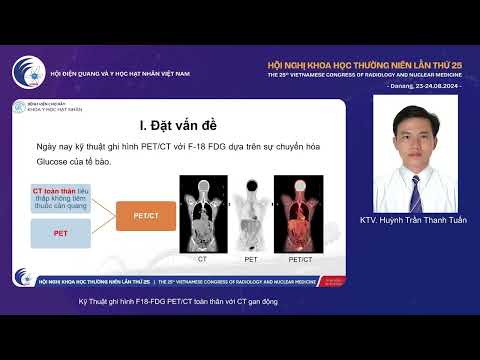 2. Kỹ Thuật ghi hình F18-FDG PET/CT toàn thân với CT gan động (KTV. Huỳnh Trần Thanh Tuấn)