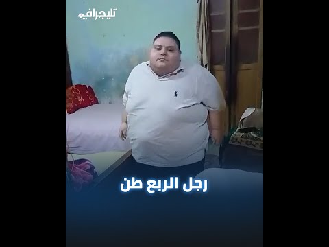 "نفسي أعيش زي الناس".. محمود وزنه 250 كيلو: أختي توفت بالسمنة وخايف أحصلها