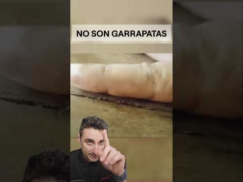 No son garraptas.#supervivencia #sabiasque #curiosidades