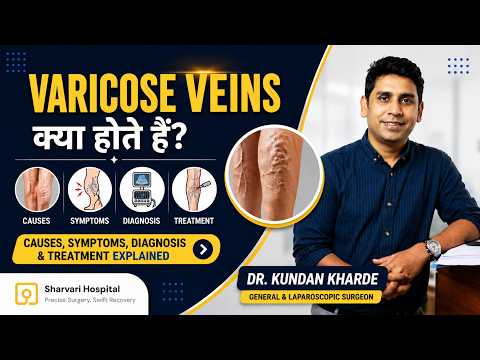 Varicose Veins Kya Hote Hain? | Causes, Symptoms & Treatment Explained | Dr. Kundan Khade