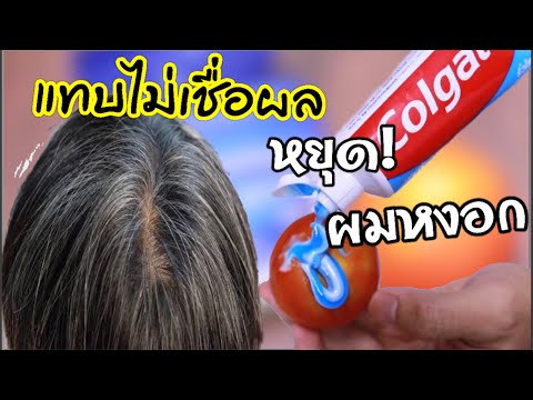 ตะลึง..!!-พบแล้ว-วิธีแก้ผมหงอก ตะลึง..!!-พบแล้ว-วิธีแก้ผมหงอก