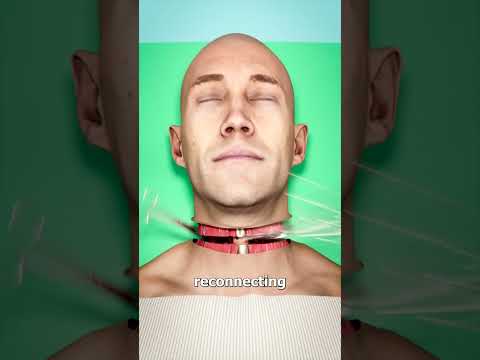 Ganzkörpertransplantation 😨 (Erklärt)