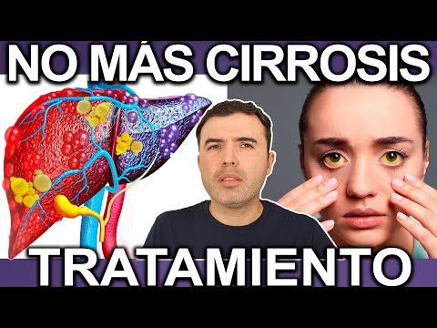 CURA LA CIRROSIS Y DAÑO DEL HIGADO - Cómo Eliminar O Frenar El Daño Hepatico