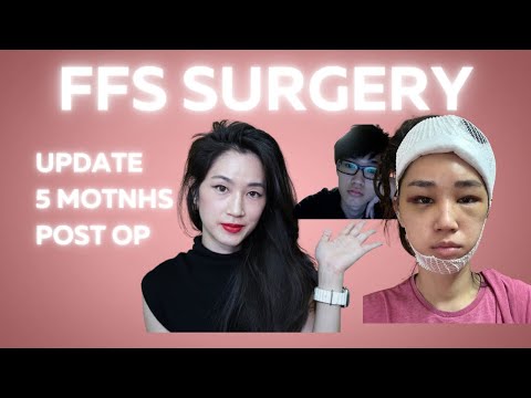 UpdateFFS5monthspostopty