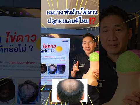 หัวล้านไข่ดาวผมบางกลางหัวปลู