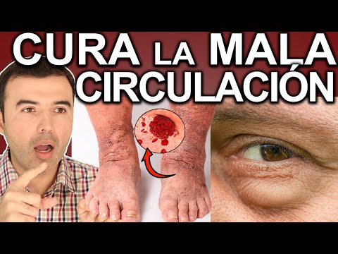 SOLUCIONA LA MALA CIRCULACIÓN - Como Mejorar La Circulacion Y Limpiar Las Arterias Y Venas