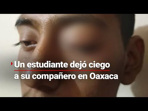 ¡Deja ciego a su compañero en Oaxaca! Juan Luis se quedó ciego después de le aventaran agua con cal