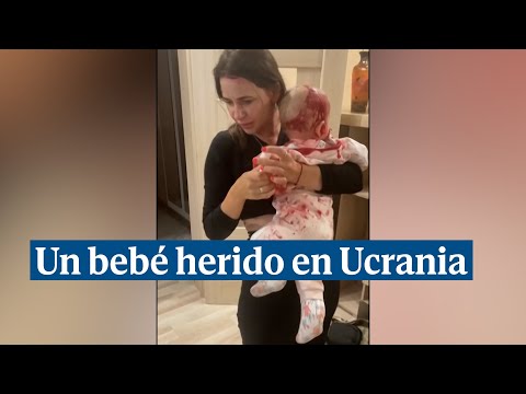Un bebé de 8 meses, entre los heridos del ataque al restaurante de Kramatorsk