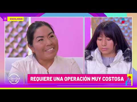 Jessica será operada para tratar la escoliosis que padece | Visita de Doctor | Sale el Sol