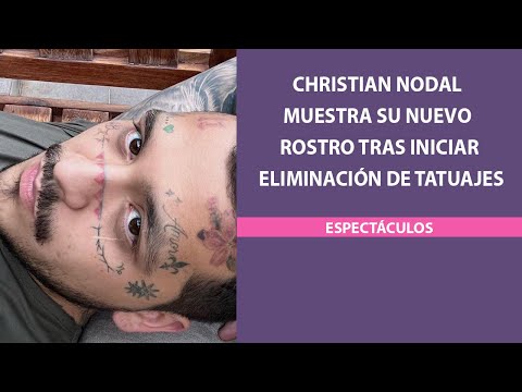 Christian Nodal muestra su nuevo rostro tras iniciar eliminación de tatuajes