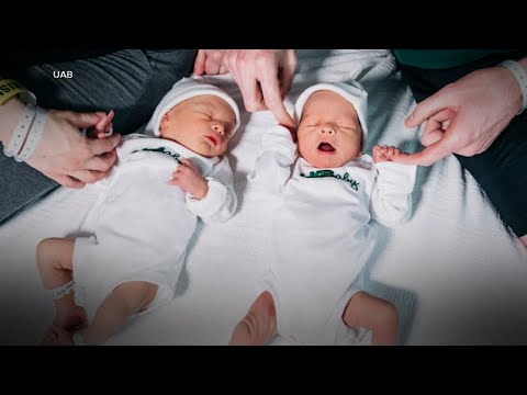 2 sets of twins born to moms with double uterus at same hospital
