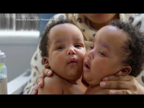 Twins celebrate 1st birthday weeks after separation surgery at Children's Hospital of Philadelphia