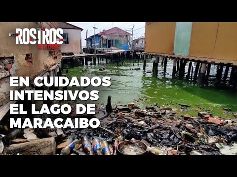 En cuidados intensivos el Lago de Maracaibo - Rostros de la Crisis