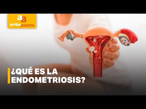 ¿Qué es la endometriosis? - Le Tengo El Remedio | CityTv