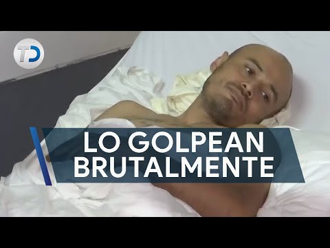 Hombre golpeó y fracturó la cadera de un migrante; pide apoyo para poder salir de hospital