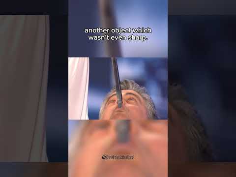 Strangest ways people have died… (Part 3) #shorts #youtubeshorts