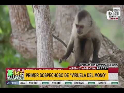 Viruela del mono: Argentina investiga primer caso sospechoso