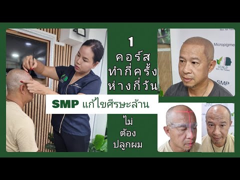 SMP1คอร์สทำกี่ครั้งห่างกันก