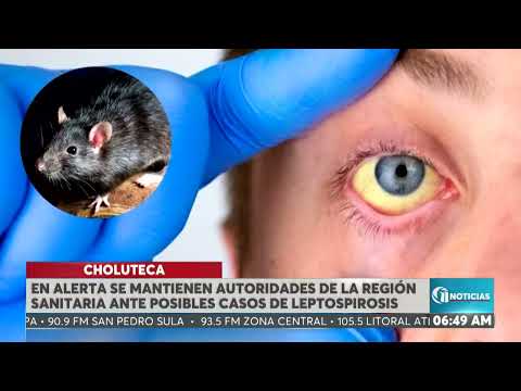 En alerta se mantienen las autoridades sanitarias de Choluteca ante posibles casos de leptospirosis