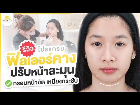 รีวิวฉีดฟิลเลอร์คางปรับใบหน้า