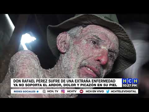 Don Rafael Pérez sufre de una extraña enfermedad en su piel, ruega por un diagnostico y tratamiento