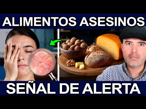 ALIMENTOS QUE TE ESTAN ENFERMANDO TODOS LOS DIAS! - Sintomas De Que Te Hacen Daño