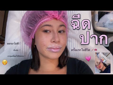 Vlog-ฉีดปากครั้งแรกในชีวิต💉