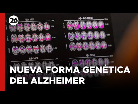 Identifican una nueva forma genética de la enfermedad de Alzheimer