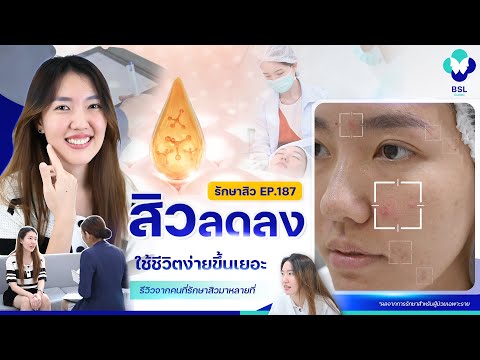 รักษาสิว|EP.187|สิวลดลงใช