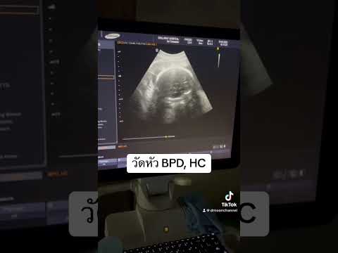 29weekspregnancyคนท้องdrno