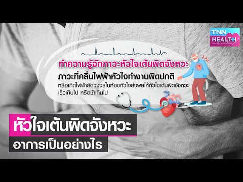 อาการหัวใจเต้นผิดจังหวะ--l-TNN อาการหัวใจเต้นผิดจังหวะ--l-TNN
