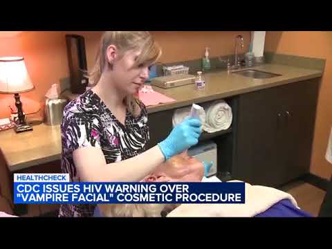 Women contract HIV after receiving 'vampire facial,' CDC says