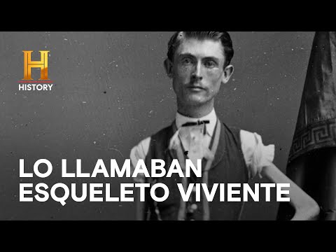 EL HOMBRE MÁS DELGADO DE LA HISTORIA - INCREÍBLE con Dan Aykroyd