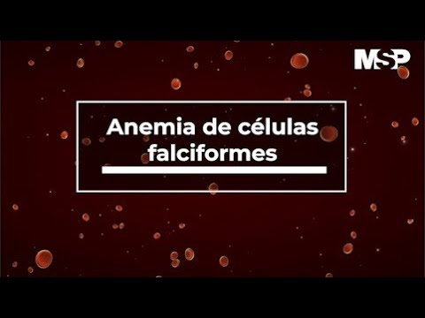 Anemia Falciforme - Dr. Alberto Santiago Cornier