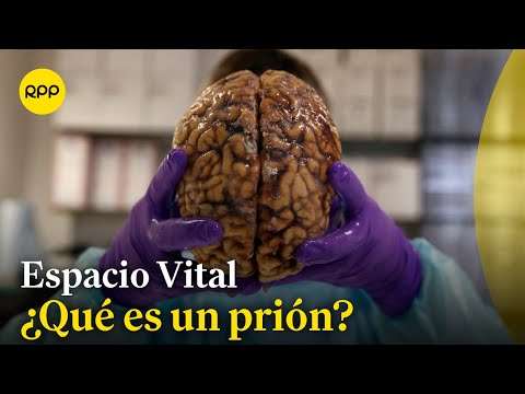 Científico español muere investigando enfermedad letal transmisible en Barcelona