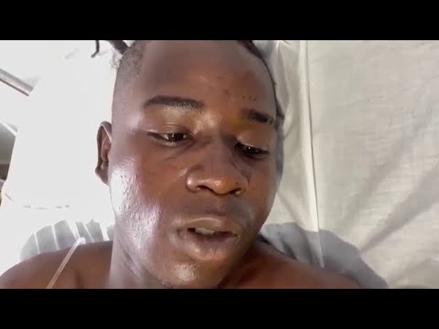 Aplican técnica barrial a nacional haitiano confundido con un ladrón en SFM