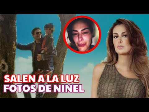 NINEL CONDE: salen a la luz IMAGENES con la cara DES.FIGURADA por GIOVANNI MEDINA