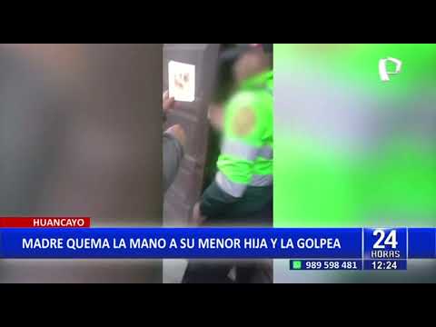 Huancayo: Detienen a mujer que quemó las manos de su hija de 9 años porque agarró dinero