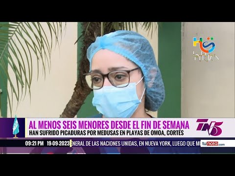 Menores hondureños sufren picaduras de medusas en playas de Omoa, Cortés