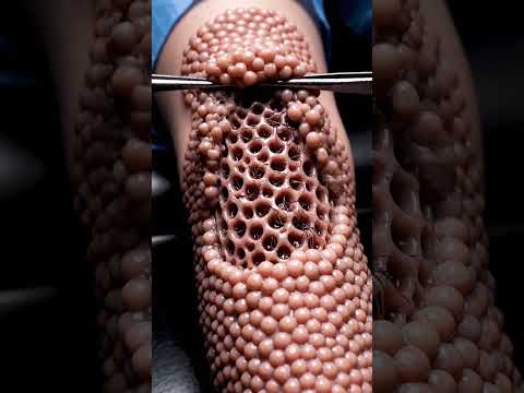 "Most INTENSE Trypophobia ASMR Ever! Deep Hive Skin Peel – Lotus Holes Under Skin 😱🔥"