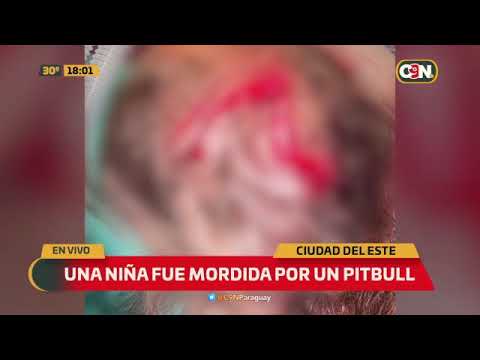 Una niña fue mordida por un pitbull