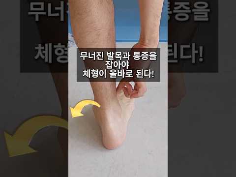 무너진 발목 아치를 올바로 세우는 운동은 이렇게 해야