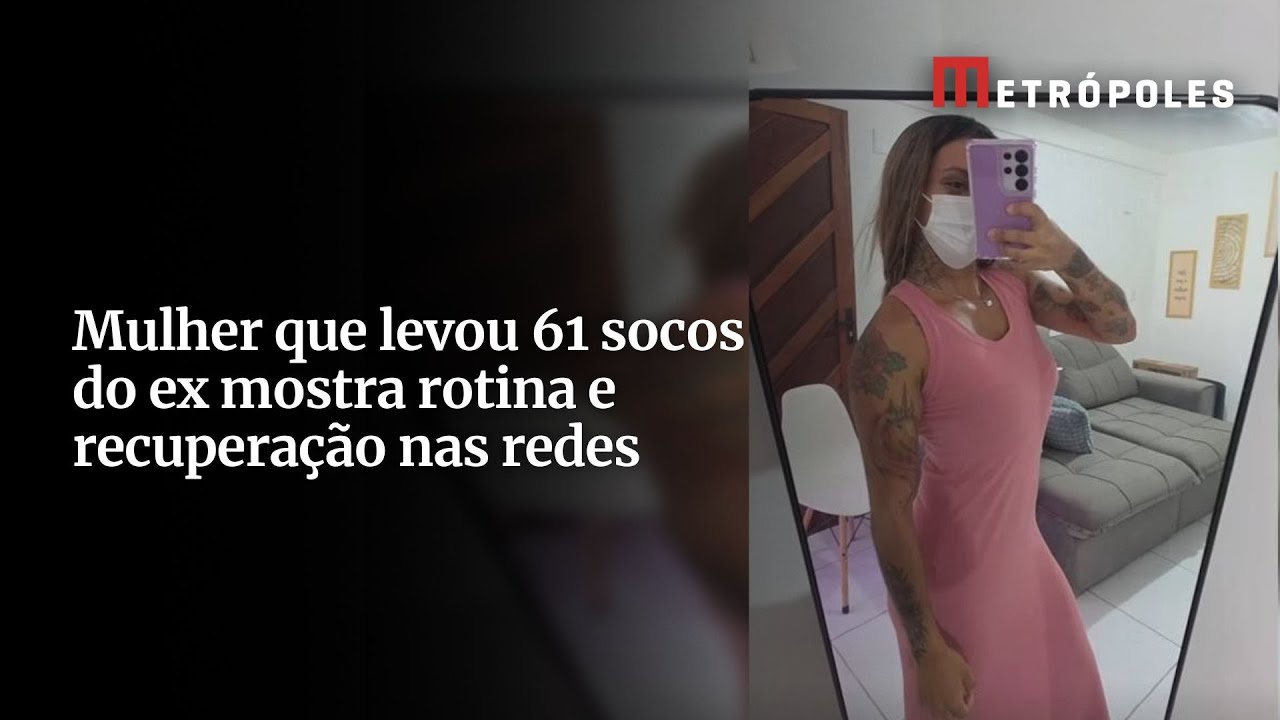 Mulher que levou 61 socos do ex mostra rotina e recuperação nas redes